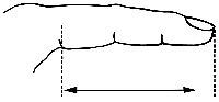 Fingerstøtte | Fingerskinne_size-guide